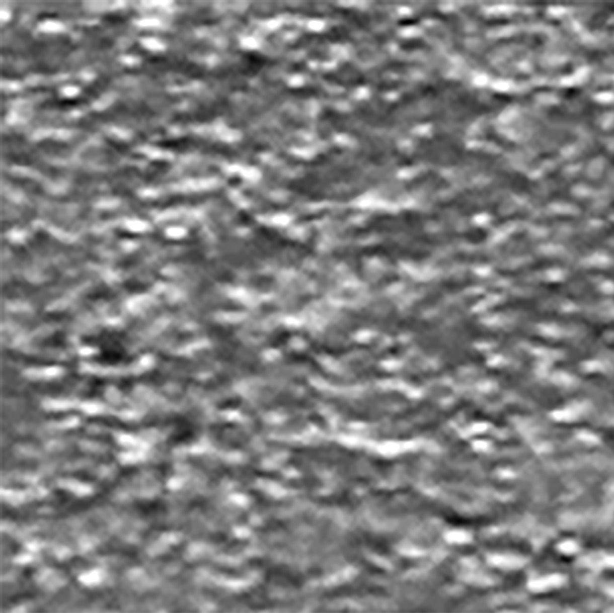 Particles (conventional illumination)